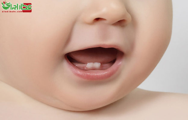 خرابی دندان و پوسیدگی دندان