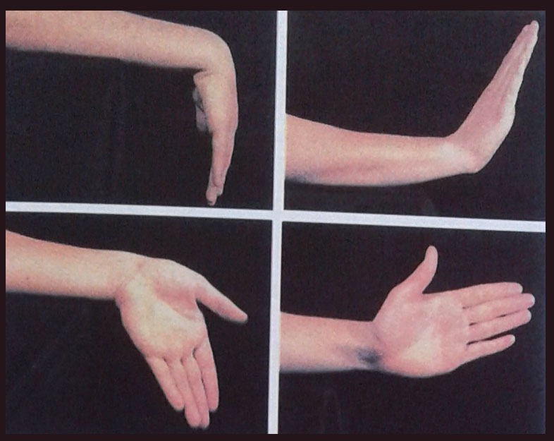 نرمشهای حرکتی مچ دست